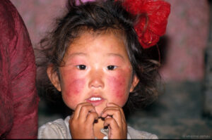 enfant des steppes aux joues rougies par le gel, particulièrement fort pendant l'hiver mongol