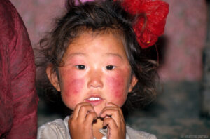 enfant des steppes aux joues rougies par le gel, particulièrement fort pendant l'hiver mongol